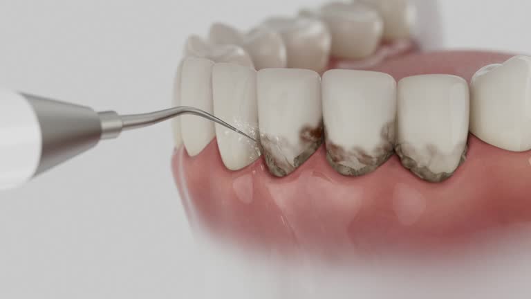 Reliable Tooth Extraction contractor in Shady Point, OK by Smile Center Dentistry